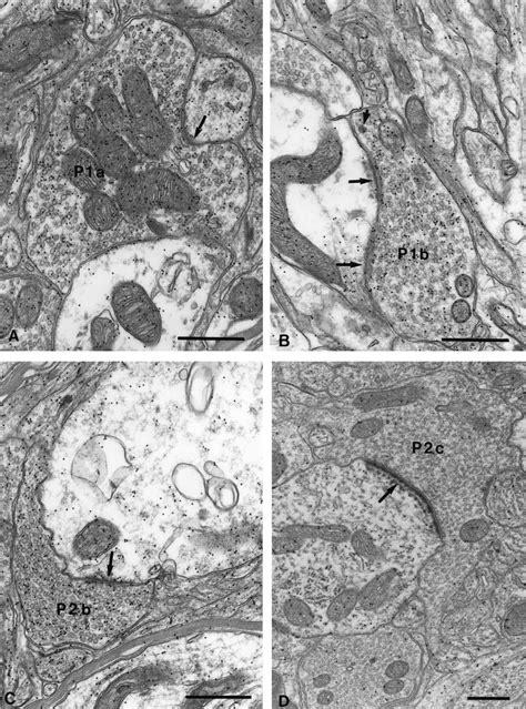 Electron Micrographs Of Glutamate Immunoreactive AC And