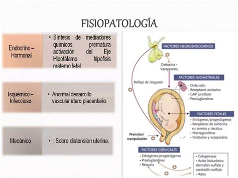 2 Amenaza De Parto Pretermino O Prematuro PPT