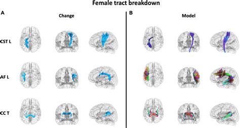 Frontiers Sex Differences In Patterns Of White Matter Neuroplasticity