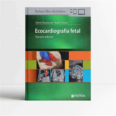 Libro Ecocardiografía fetal 3era edición en Campus