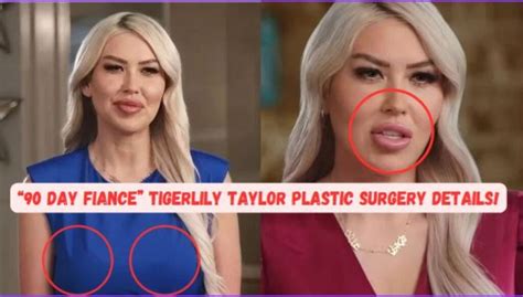 90 Day Fiance Tigerlily Taylor Plastic Surgery Breakdown