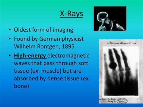 Ppt Medical Imaging Powerpoint Presentation Free Download Id 3006805