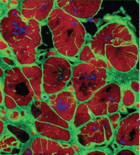 Hallmark Of Adult Human Myocar Image Eurekalert Science News Releases