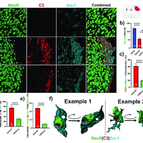 Complement Inhibition Reduces Microglia Macrophage Association With And