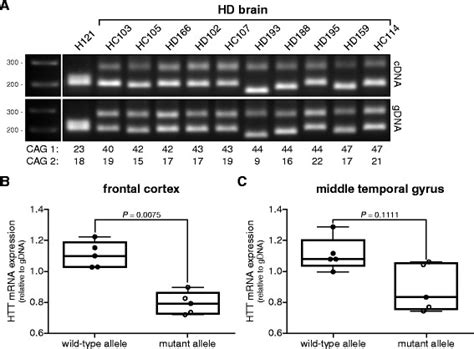 Wild Type And Mutant Htt Mrna Levels In Adult Onset Hd Brain Tissue Download Scientific