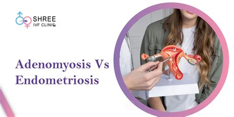 A Quick Overview Of The Adenomyosis Stages Dr Jay Mehta