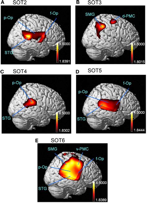 Frontiers Cerebral Hemodynamic Responses During Dynamic Posturography