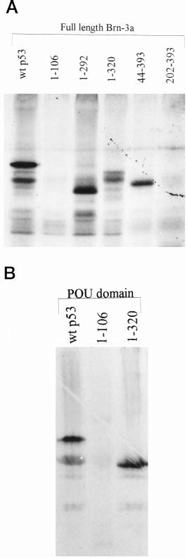 Sds Polyacrylamide Gel Electrophoresis Analysis Of Products Retained By Download Scientific