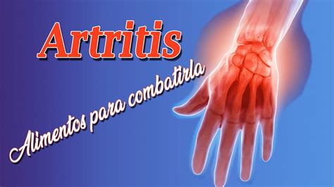 Artritis Alimentos Para Combatirla Y Lo Que No Debes Tomar Youtube