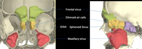 Pathology Of Maxillary Sinus Flashcards Quizlet