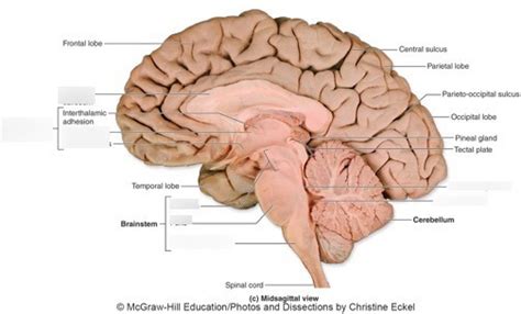 Midsagittal Section Of The Brain Color Coded