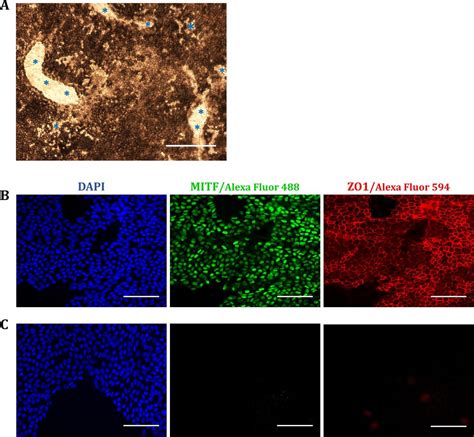 Comparison Of Human Amniotic Membrane Decellularisation Approaches For