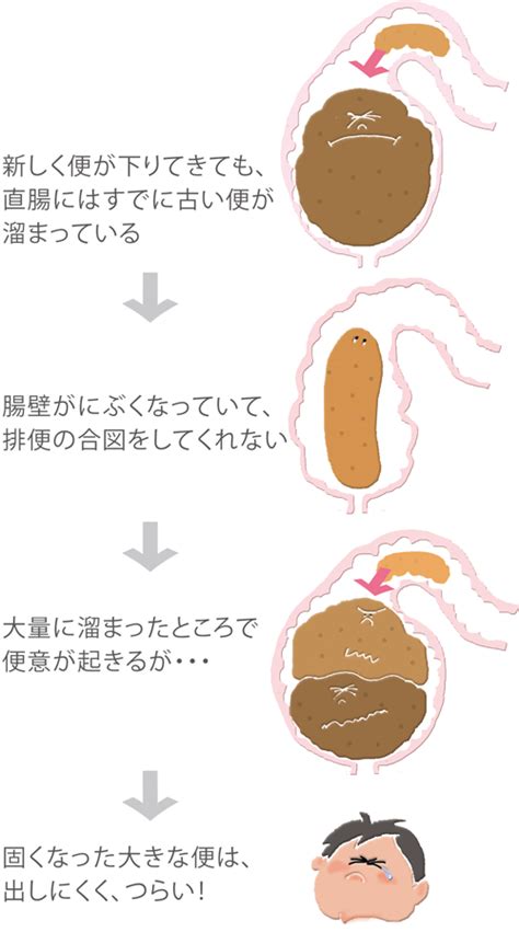 便秘について｜ムネ製薬株式会社