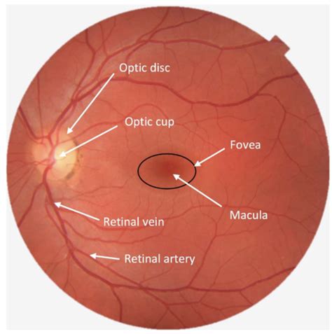 Week 1 Reflection Refraction And Thin Lenses Flashcards Quizlet