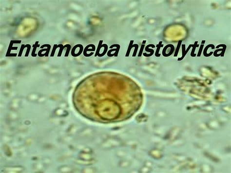 Entamoeba Histolytica Under Microscope