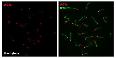 Anti-Centromere Protein Antibody