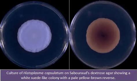 Histoplasma capsulatum: Properties, Diseases, Lab Diagnosis • Microbe ...