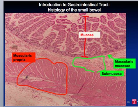 Colorectal Cancer Flashcards Quizlet