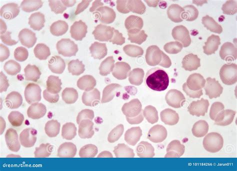 Lymphocyte cell stock photo. Image of cells, hematology - 101184266