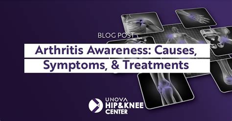 Arthritis awareness: Causes, Preventative Care, and Treatments — UNOVA Hip & Knee Center I Best ...