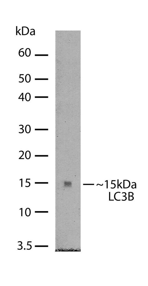 Lc B Recombinant Polyclonal Antibody Invitrogen G Unconjugated