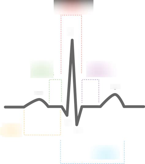 Ecg Graph Labeled Diagram Quizlet