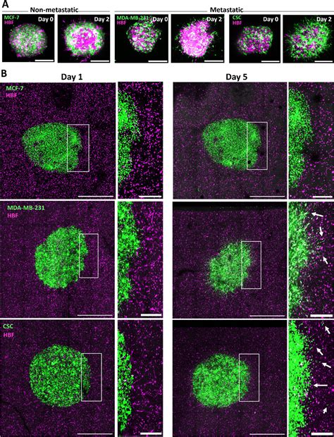 D Bioprinted Tumor Stroma Models Of Triple Negative Breast Cancer Stem