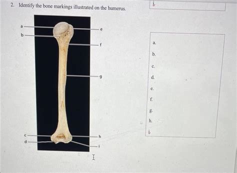 Solved Identify The Bone Markings Illustrated On The Chegg