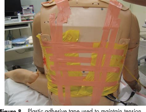 Figure 13 From Moulage In High Fidelity Simulation A Chest Wall Burn