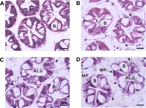 Histological Observations In Hepatopancreas Of L Vannamei After Mps