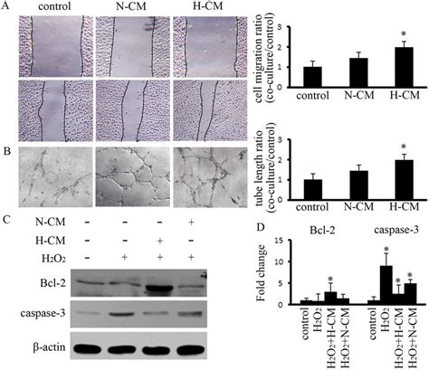 Hypoxia Pretreatment Of Bm Mscs Enhanced The Capacity For Angiogenesis