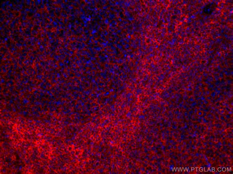 Hla Class I Hla A Fusion Protein Ag7488 Proteintech 武汉三鹰生物技术有限公司