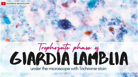 Trophozoite Phase Of Giardia Lamblia Under The Microscope With Trichrome Stain Youtube