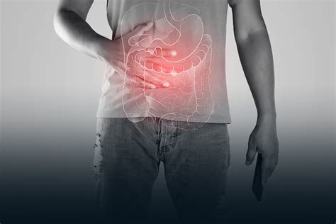 Recomendações Para A Prevenção Do Câncer De Intestino Confira