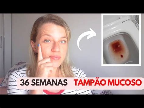 Saiu O Tamp O Mucoso Semanas Youtube