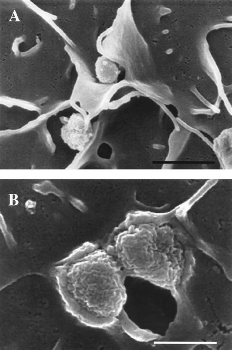 Scanning electron micrographs of gonococci invading HUEC at 1 h ...