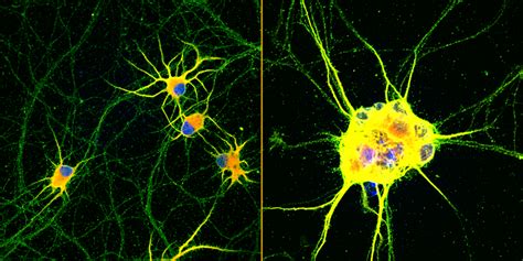 Enhanced Neurons [image] Eurekalert Science News Releases