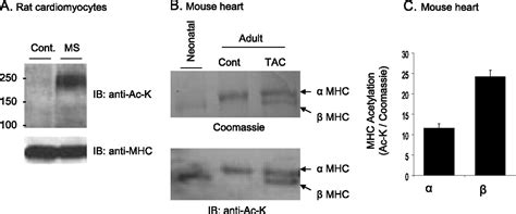 Hdac Dependent Reversible Lysine Acetylation Of Cardiac Myosin Heavy