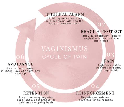 Understanding Vaginismus Causes Symptoms And Effective Treatments