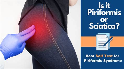 Is It Piriformis Or Sciatica Best Self Test For Piriformis Syndrome