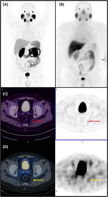 Frontiers Radiochemical And Biological Assessments Of A PSMA I S Cold