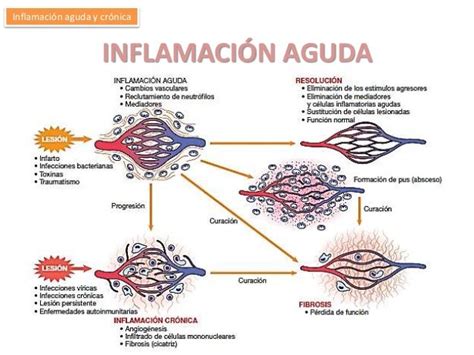 Inflamación Aguda Y Crónica