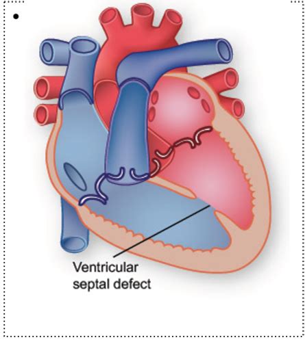 Nr Quiz Cardiac Flashcards Quizlet