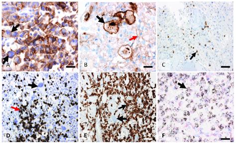 Different Representative Examples Of Immunohistochemistry Against