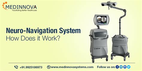 What Is Neuro Navigation System How Does It Work Medinnova