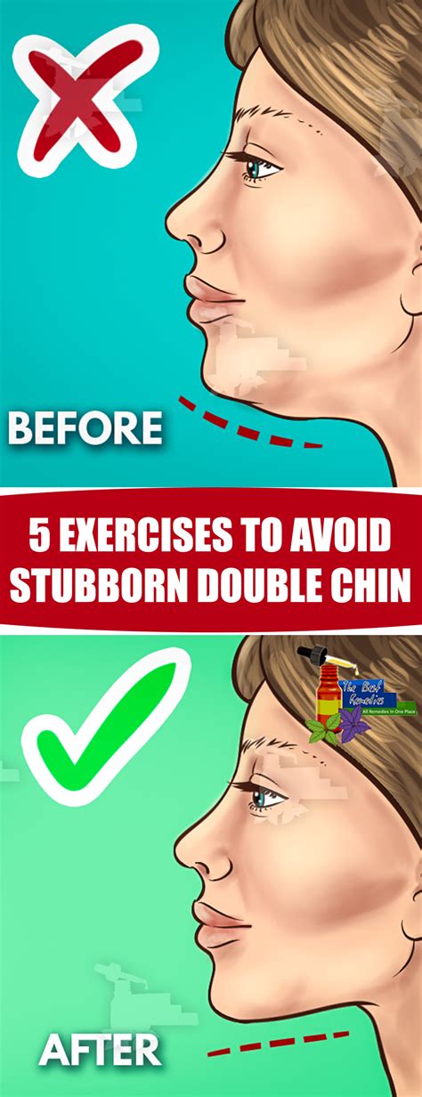 5 Exercises To Avoid Stubborn Double Chin