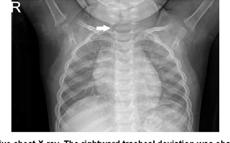 Figure From The Usefulness Of Rocuronium And Sugammadex In The