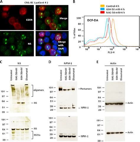 Expression Of NS In CD34 CML BC Cells And Reversal Of ROS Mediated