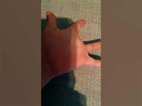 Funny Shorts Missing Finger 😂😂😂😂 Youtube