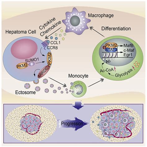 Ectosomal Pkm2 Promotes Hcc By Inducing Macrophage Differentiation And Remodeling The Tumor